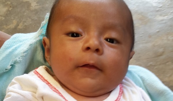 Photo of Wilmer post-operation