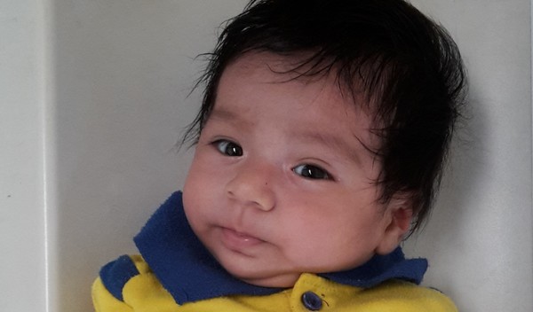 Photo of Luis post-operation