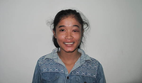 Photo of Srey Neang post-operation