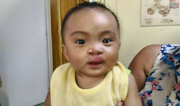 Photo of Zion post-operation