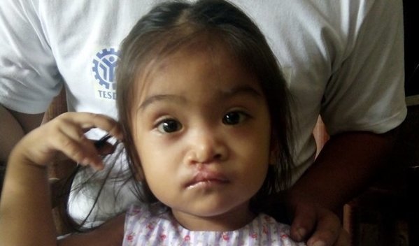 Photo of Freiysha post-operation
