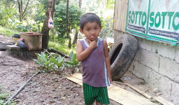 Photo of Emmanuel post-operation