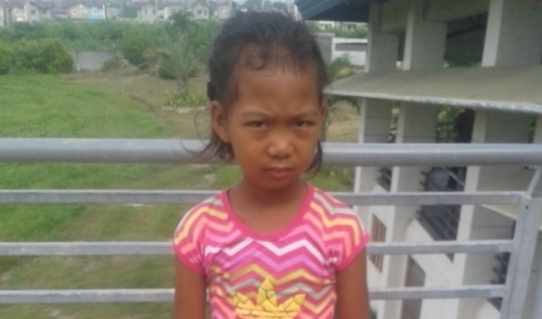 Photo of Ronalyn post-operation