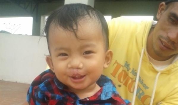 Photo of Raynie post-operation