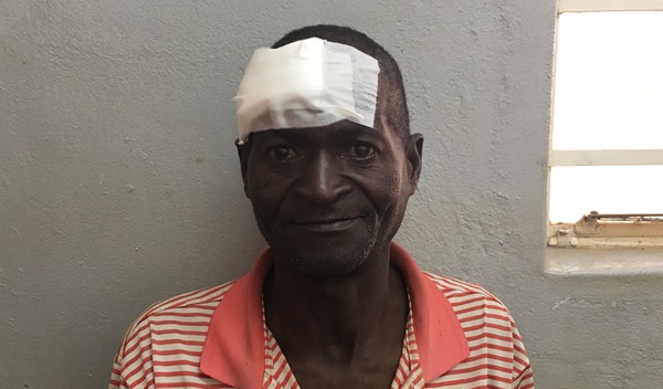 Photo of Edward post-operation