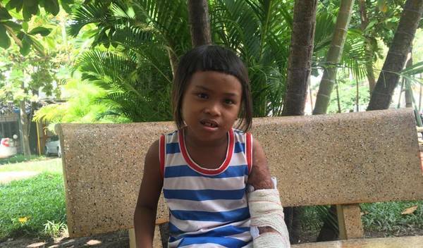 Photo of Srey Kann post-operation