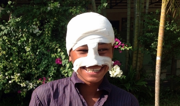 Photo of Chanrong post-operation