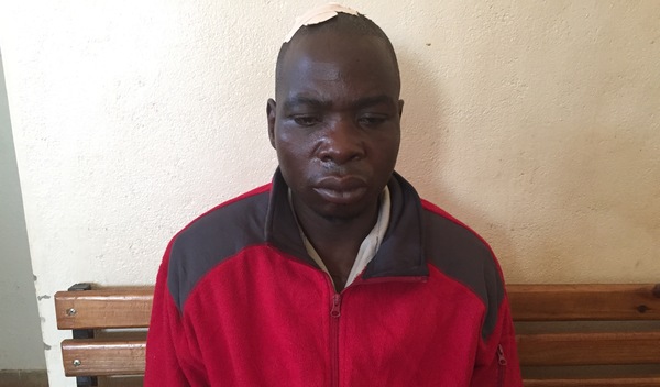 Photo of Fransisco post-operation