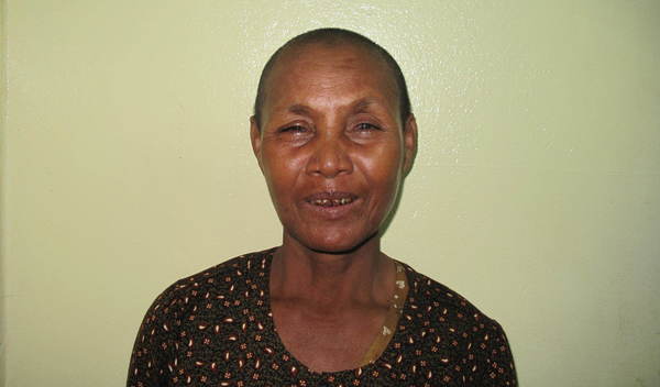 Photo of Yen post-operation
