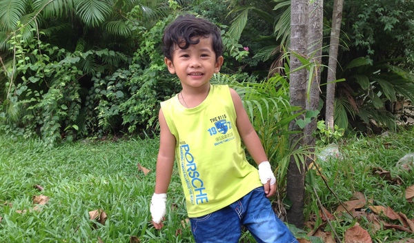 Photo of Piseth post-operation