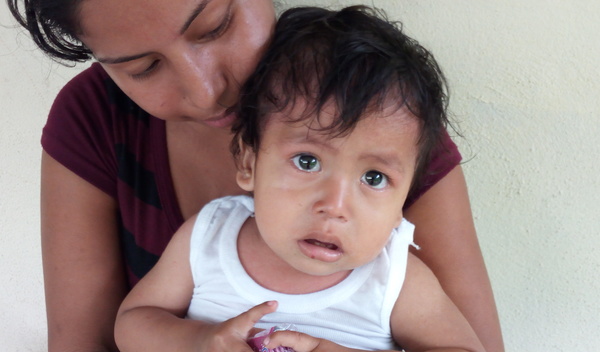 Photo of Esdras post-operation