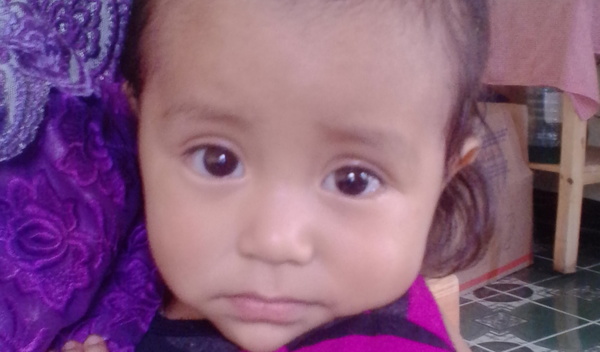 Photo of Maria post-operation