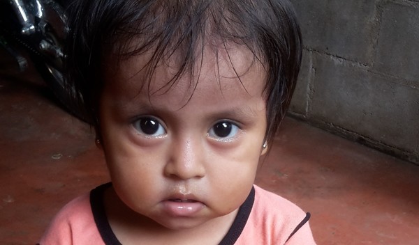 Photo of Clemencia post-operation