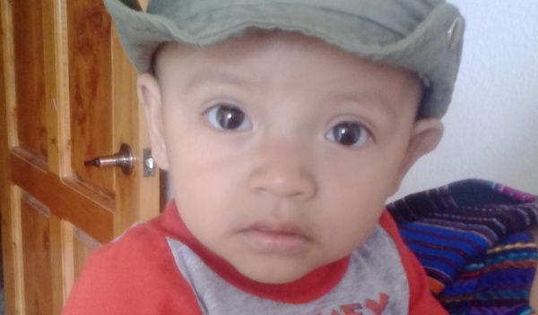Photo of Nicolas post-operation