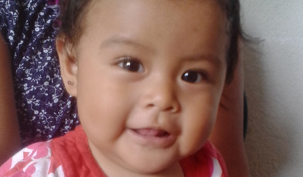 Photo of Sayda post-operation