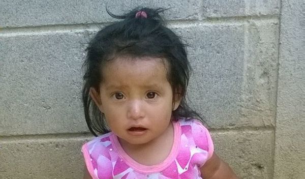 Photo of Carmen post-operation