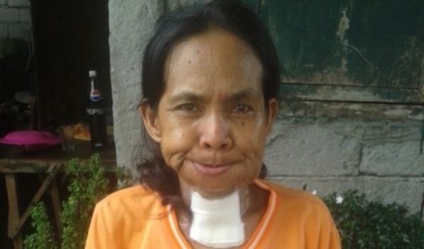 Photo of Rosalie post-operation