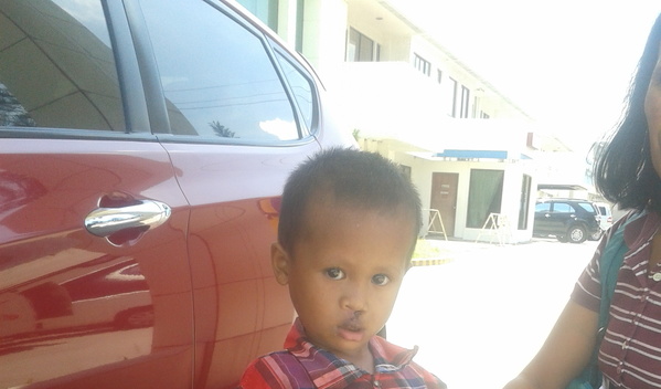 Photo of Adonis post-operation