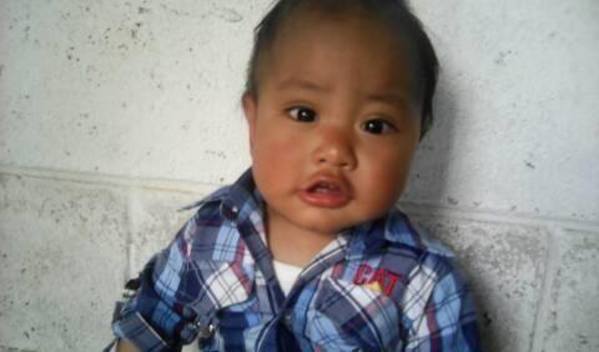 Photo of Bryan post-operation