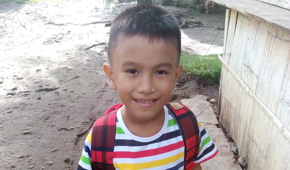 Photo of Junryl post-operation