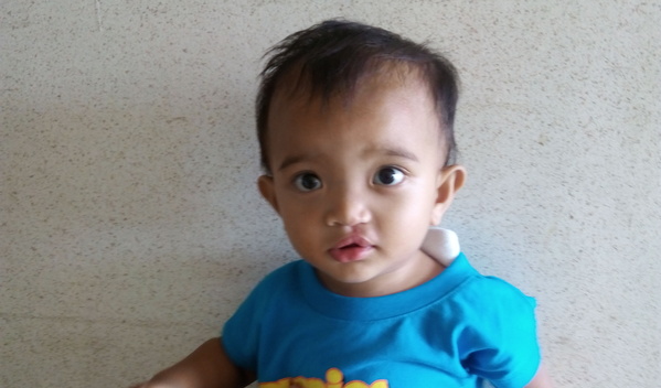 Photo of Clarence post-operation