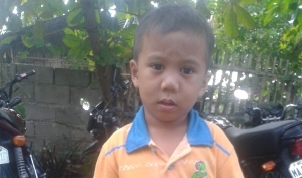 Photo of Riane post-operation