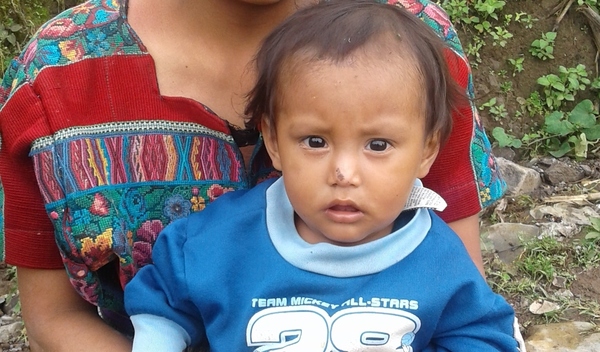 Success! Edgar from Guatemala raised $837 to fund malnutrition ...