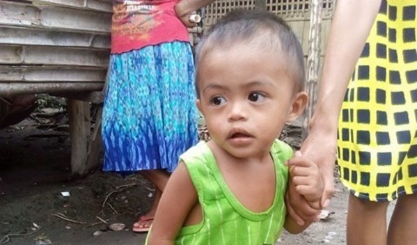 Photo of Alvin post-operation