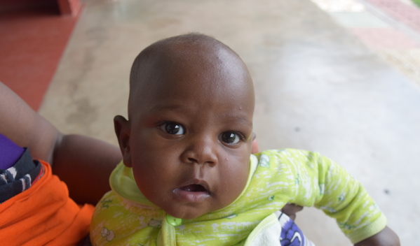 Photo of Sanare post-operation