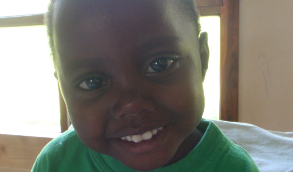 Photo of Neema post-operation