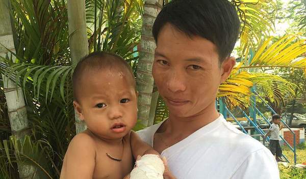 Photo of Chhanun post-operation