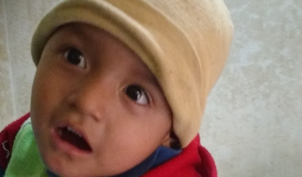 Photo of Gustavo post-operation