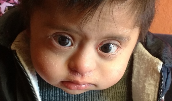 Photo of Carlos post-operation