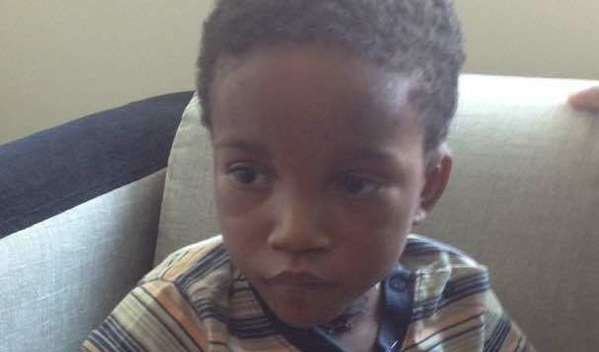 Photo of Sebastien post-operation