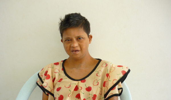 Photo of Sandar post-operation