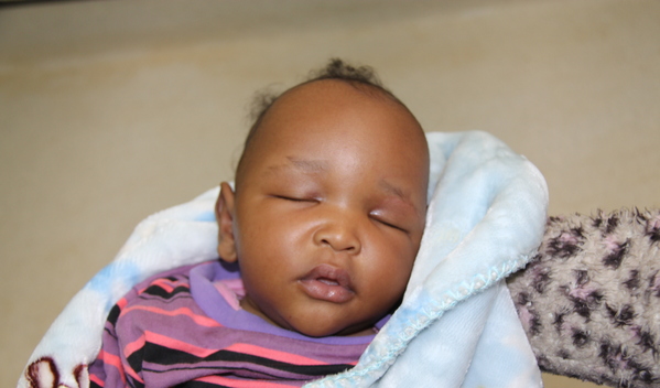 Photo of Nickson post-operation