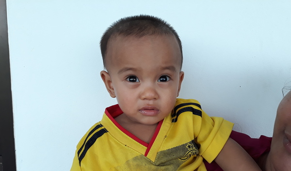 Photo of Aung post-operation