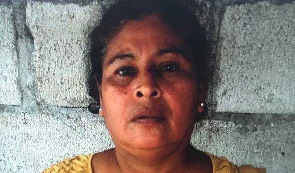 Photo of Floridalma post-operation