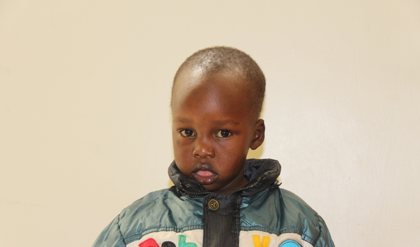 Photo of Levis post-operation