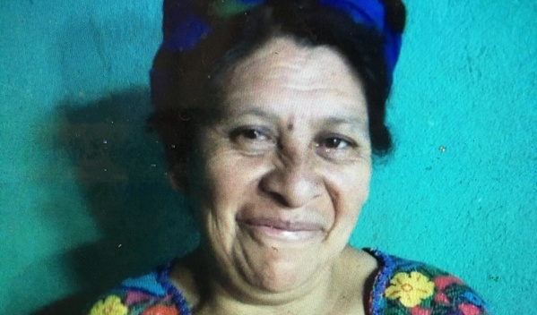 Photo of Alma Olivia post-operation