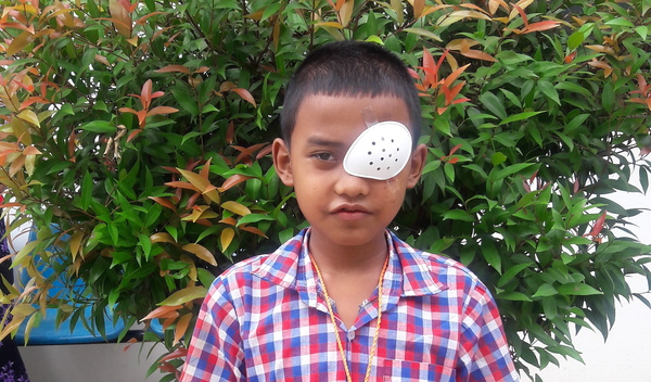 Photo of Kyaw Zin post-operation