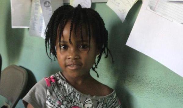 Photo of Yanara post-operation