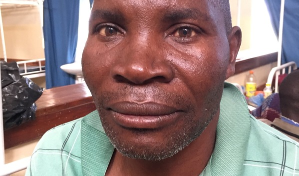 Photo of Sigalawo post-operation