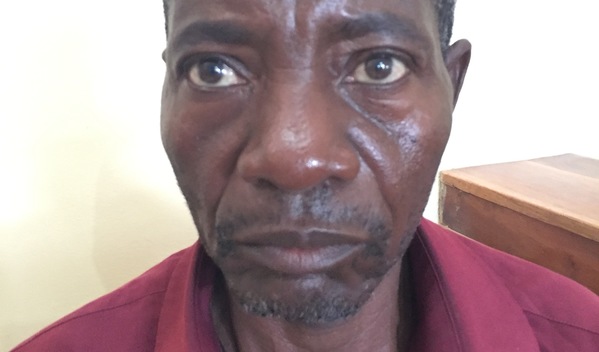 Photo of Filias post-operation