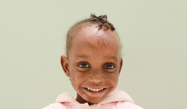 Photo of Angel post-operation