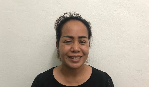 Photo of Dola post-operation