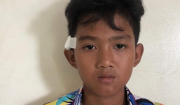 Photo of Socheat post-operation