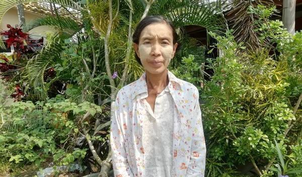Photo of Myint post-operation