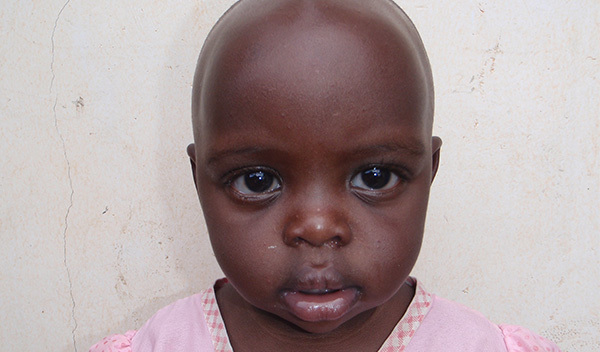 Photo of Elizabeth post-operation