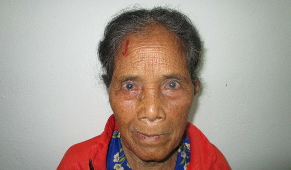 Photo of Pulong post-operation